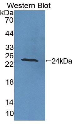 Polyclonal Antibody to Protein Tyrosine Phosphatase Receptor Type A (PTPRA)