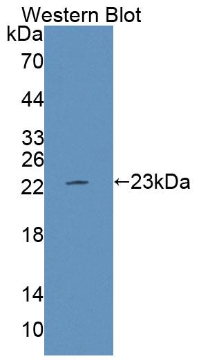 Polyclonal Antibody to Protein Tyrosine Phosphatase Receptor Type E (PTPRE)