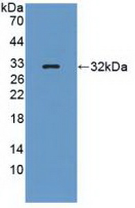 Polyclonal Antibody to Protein Tyrosine Phosphatase Receptor Type Q (PTPRQ)