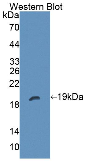 Polyclonal Antibody to Protein Tyrosine Phosphatase Receptor Type Z (PTPRZ)