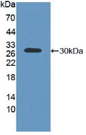 Polyclonal Antibody to ATP Binding Cassette Transporter C2 (ABCC2)