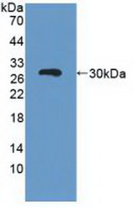 Polyclonal Antibody to ATP Binding Cassette Transporter C3 (ABCC3)