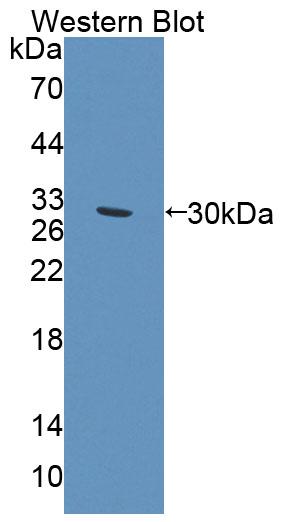 Polyclonal Antibody to ATP Binding Cassette Transporter C11 (ABCC11)