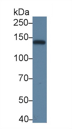 Polyclonal Antibody to ATP Binding Cassette Transporter B4 (ABCB4)