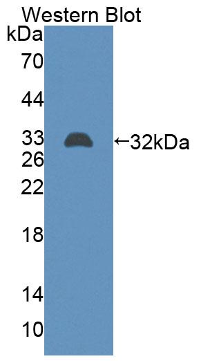 Polyclonal Antibody to ATP Binding Cassette Transporter B9 (ABCB9)