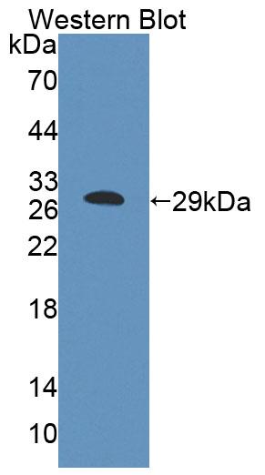 Polyclonal Antibody to ATP Binding Cassette Transporter F1 (ABCF1)