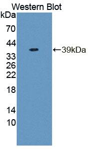 Polyclonal Antibody to Regulator Of G Protein Signaling 9 (RGS9)