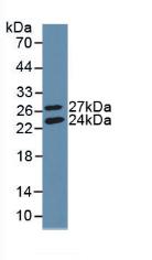 Polyclonal Antibody to Glutathione Synthetase (GSS)