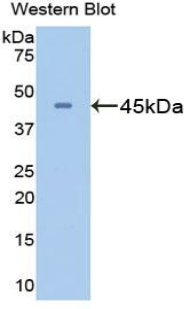 Polyclonal Antibody to Glutamine synthetase (GS)