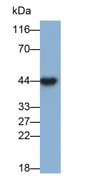 Polyclonal Antibody to Glutamine synthetase (GS)