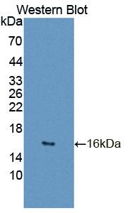 Polyclonal Antibody to General Transcription Factor IIA, Polypeptide 2 (GTF2A2)