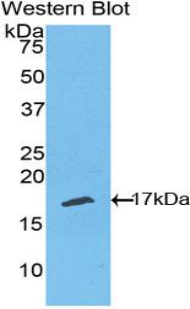 Polyclonal Antibody to Tumor Necrosis Factor Receptor Superfamily, Member 19 Like Protein (TNFRSF19L)