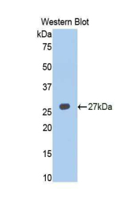 Polyclonal Antibody to Tumor Necrosis Factor Receptor Superfamily, Member 14 (TNFRSF14)