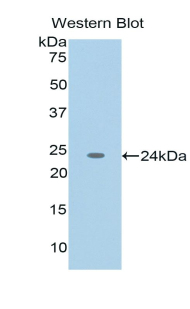 Polyclonal Antibody to Tumor Necrosis Factor Ligand Superfamily, Member 12 (TNFSF12)