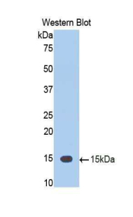 Polyclonal Antibody to Tumor Necrosis Factor Ligand Superfamily, Member 12 (TNFSF12)