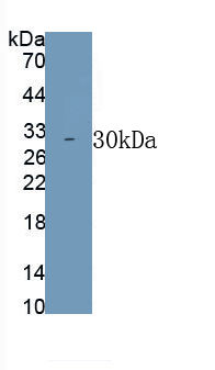 Polyclonal Antibody to Tumor Necrosis Factor Ligand Superfamily, Member 12 (TNFSF12)