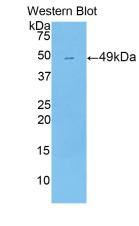 Polyclonal Antibody to Pregnane X Receptor (PXR)