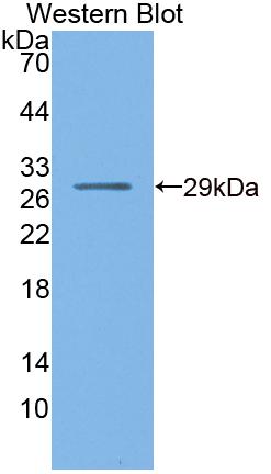 Polyclonal Antibody to Nuclear Receptor Subfamily 0, Group B, Member 1 (NR0B1)