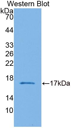 Polyclonal Antibody to Calcium Binding Protein 1 (CABP1)