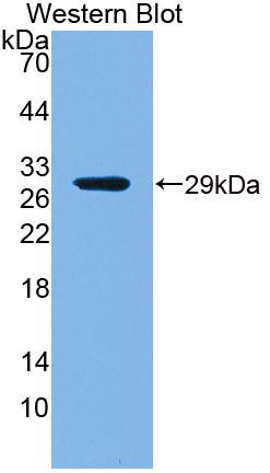 PAE031Hu01.jpg