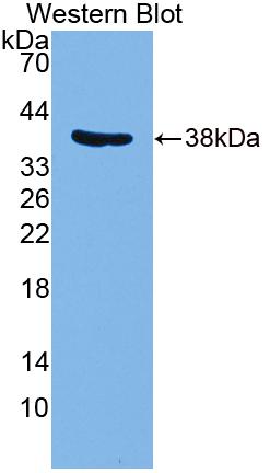 PAE036Hu01.jpg