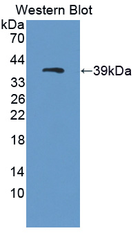 PAE047Hu01.jpg