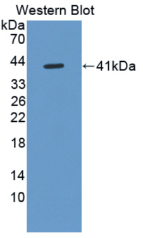 PAE134Hu01.jpg