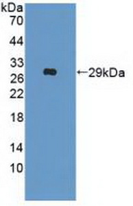 PAE171Hu01.jpg