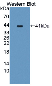 Polyclonal Antibody to Proprotein Convertase Subtilisin/Kexin Type 5 (PCSK5)