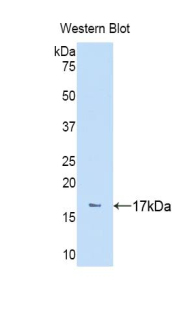 Polyclonal Antibody to Puromycin Sensitive Aminopeptidase (PSA)