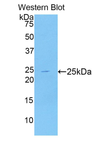 Polyclonal Antibody to Puromycin Sensitive Aminopeptidase (PSA)