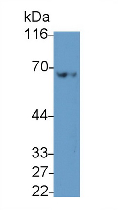 Polyclonal Antibody to Baculoviral IAP Repeat Containing Protein 2 (BIRC2)