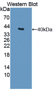 Polyclonal Antibody to Baculoviral IAP Repeat Containing Protein 6 (BIRC6)