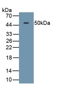 Polyclonal Antibody to Tryptophan-2,3-dioxygenase (TDO)