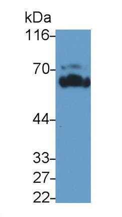 Polyclonal Antibody to B-Lymphoid Tyrosine Kinase (BLK)