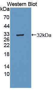 Polyclonal Antibody to C-Mer Proto Oncogene Tyrosine Kinase (MERTK)