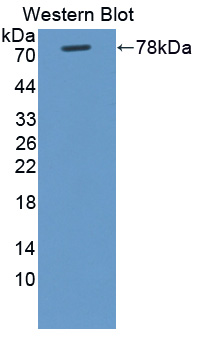 Polyclonal Antibody to Rac-GTPase Activating Protein 1 (RACGAP1)