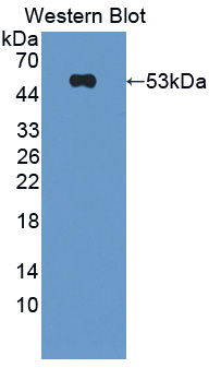 Polyclonal Antibody to Rho GDP Dissociation Inhibitor Beta (ARHGDIb)