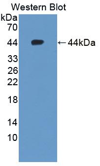 Polyclonal Antibody to Sodium Iodide Symporter (NIS)