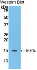 Polyclonal Antibody to Solute Carrier Family 30 Member 8 (SLC30A8)