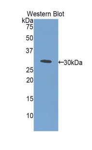 Polyclonal Antibody to Electron Transfer Flavoprotein Alpha Polypeptide (ETFa)