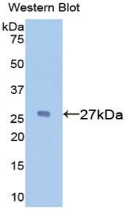 Polyclonal Antibody to Alpha-1-B-Glycoprotein (a1BG)