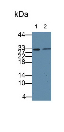 Polyclonal Antibody to Ubiquitin Conjugating Enzyme E2S (UBE2S)