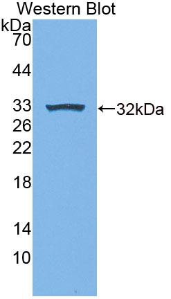 Polyclonal Antibody to Ubiquitin Conjugating Enzyme E2S (UBE2S)