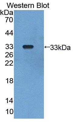 Polyclonal Antibody to Glomulin (GLMN)