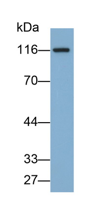 Polyclonal Antibody to N-Acylsphingosine Amidohydrolase 2 (ASAH2)