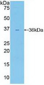 Polyclonal Antibody to Interleukin 22 Receptor (IL22R)