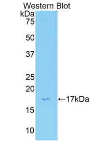 Polyclonal Antibody to Annexin A3 (ANXA3)