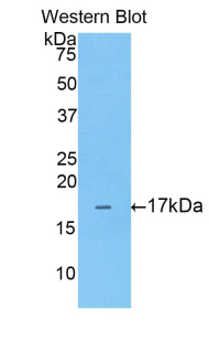 Polyclonal Antibody to Annexin A3 (ANXA3)