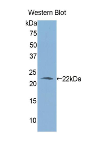 Polyclonal Antibody to Aldehyde Dehydrogenase 1 Family, Member A3 (ALDH1A3)